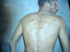 Port Said General Prison Torture Victim